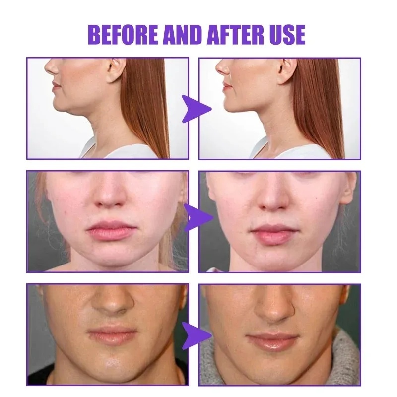 Face-lift Slimming Cream Slimm - Anti-Aging Face Cream 评论和价格